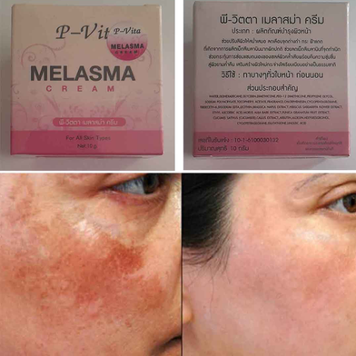 Bioaqua P Vita Melasma Mesta Whitening Cream 10g